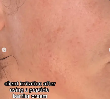 Hvor meget peptider er for meget peptider?