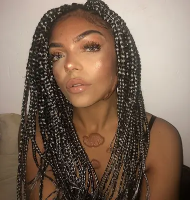 Bianca Honey Bee Keloid Scars