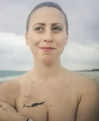 Body Positivity: Port Scar