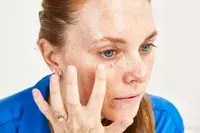 A person applies Beauty of Joseon Revive eye serum : Ginseng + Retinal