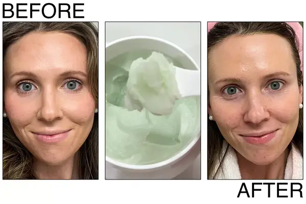 before and after of a person using the Farmacy Cleansing Balm