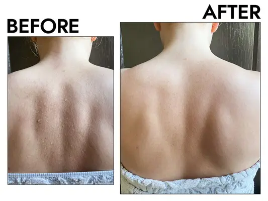 Neutrogena Clear Pore Cleanser/Mask