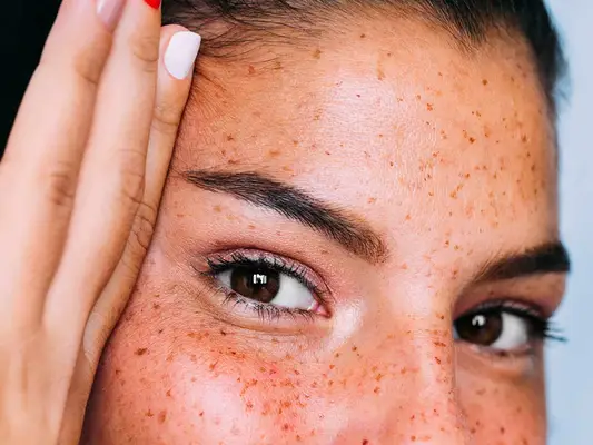 Botox Brow Lifts est une option de traitement non invasive sans temps d'arrêt