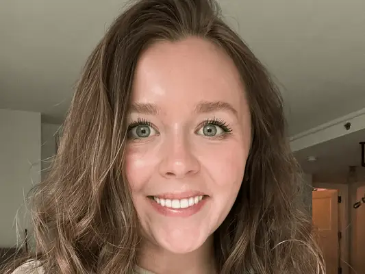 after photo of woman with smile transformation