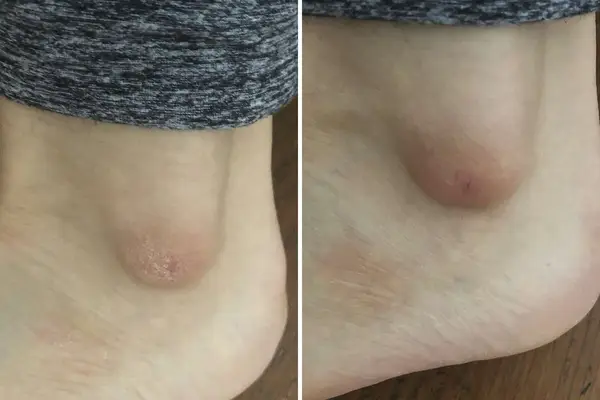 weleda skin food ultra-rich body cream