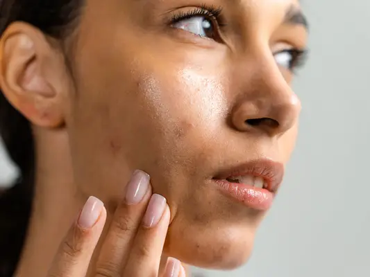 A woman applying cream to her face, her head to the side