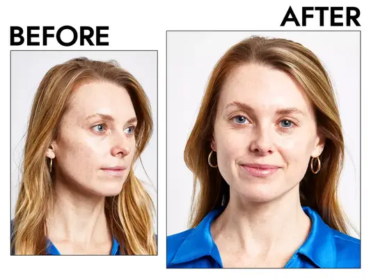 before and after photos of a person using the Neutrogena Rapid Wrinkle Repair Eye Cream