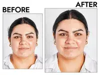 Photos of person’s face before and after using The Inkey List Caffeine Eye Cream