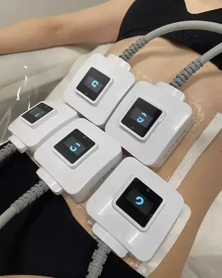 The TruSculpt ID on a woman