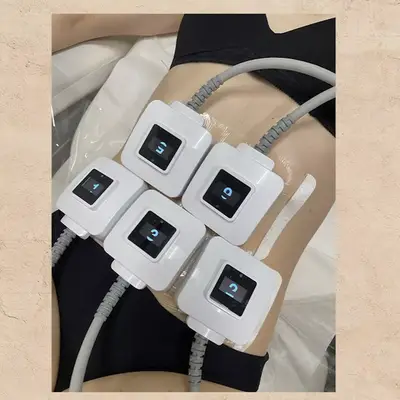 J'ai essayé le contour du corps TruSculpt ID : voici mes pensées honnêtes