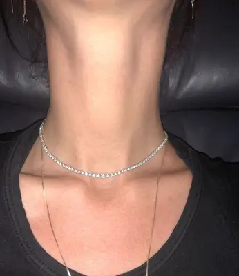 after neck Botox