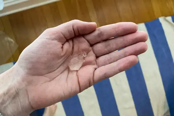 Hand holding a quarter size amount of Peach Slices Snail Rescue Intensive Wash-Off Jelly Mask