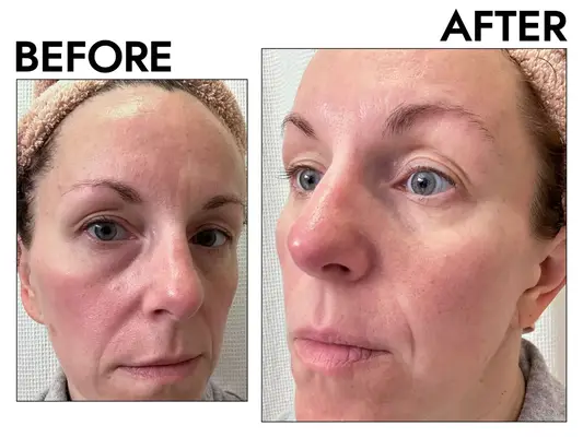 Various skincare products including masks and serums arranged on a neutral background