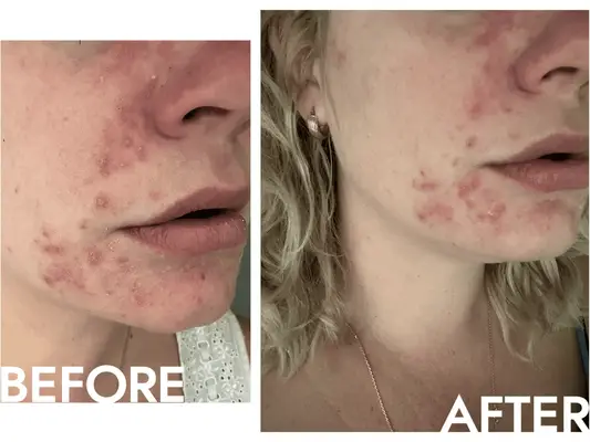 a before and after of the Kiehl