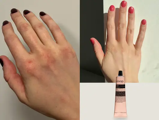 Denne aesop håndcreme genoplivede min tørre, vind-slog vinterhud