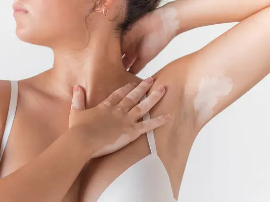 Close up of a woman, one hand on chest, other arm up, her armpit exposed