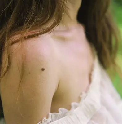 Woman with mole on shoulder