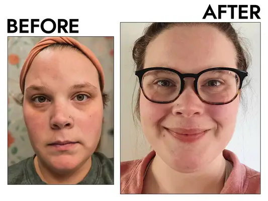 Environ Micro-Needling Gold Cosmetic Roll CIT