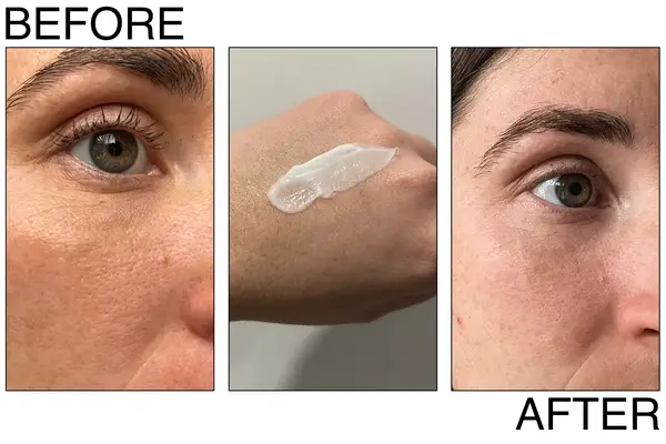 SkinMedica HA5 Rejuvenating Hydrator