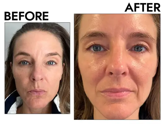 Alpyn Beauty Super Peptide & Ghostberry Moisturizer