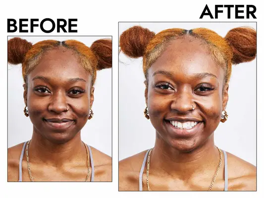 A jar of Beautystat Universal Pro-Bio Moisture Boost Cream with the cap off