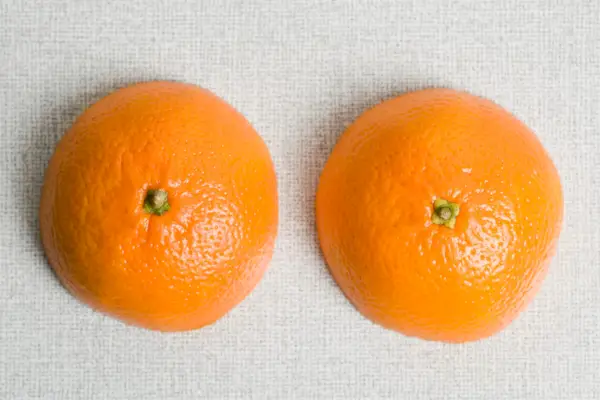 Alle TMI-spørsmålene dine om hvordan vekttap påvirker brystene dine – besvart