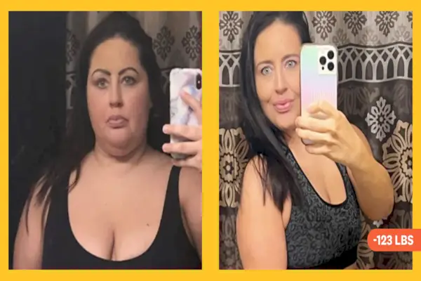 Honey Boo Boo poddaje się operacji odchudzającej o wartości 13 tys. dolarów: wszystko o procedurze endoskopowego rękawa z wyrzeźbieniem szwów