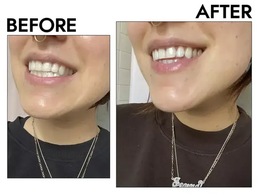 Crest 3D White Whitestrips