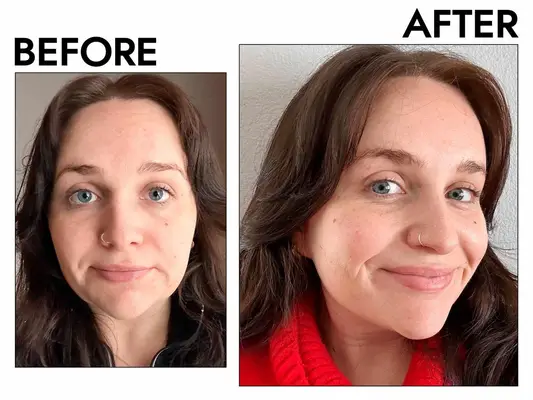 SkinCeuticals Metaceli Renewal B3