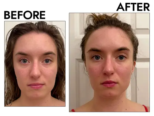 The Ordinary Niacinamide 10% + Zinc 1% Oil Control Serum 