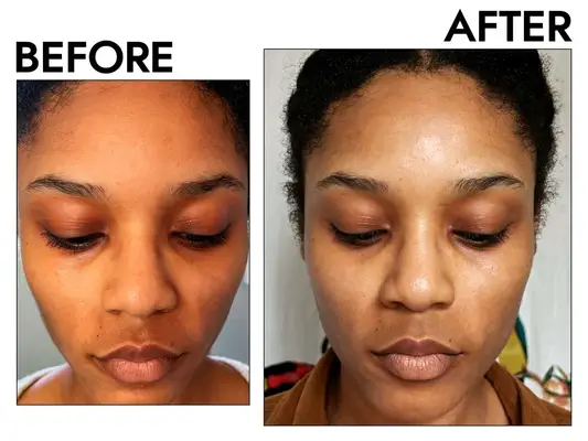 Ulta Sunday Riley B3 Nice 10% Niacinamide Serum