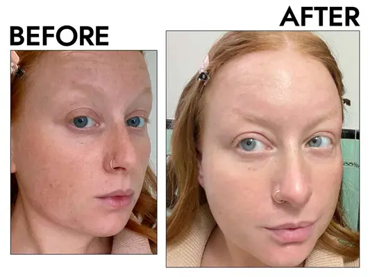 Glow Recipe Niacinamide Dew Drops 