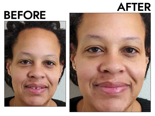 Typology 12% Niacinamide Serum