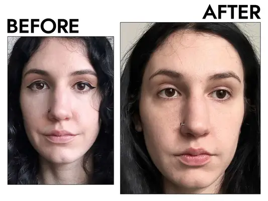 Three skincare products, including SkinCeuticals Metacell Renewal B3, Glossier Super Pure, and The Ordinary Niacinamide serum