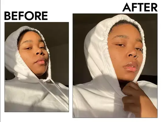Photos of person’s face before and after using Laneige Lip Sleeping Mask