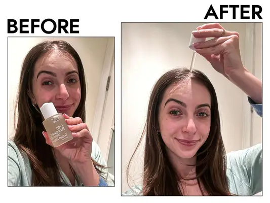 Act+ Acre Stem Cell Scalp Serum