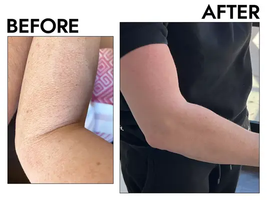 AmLactin Daily Moisturizing Body Lotion