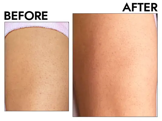 Eczema Honey Oatmeal Body Lotion