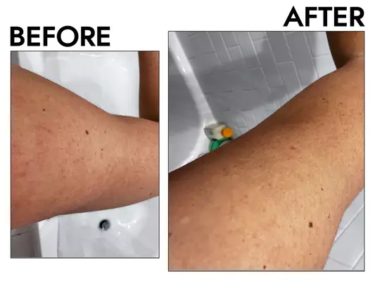 First Aid Beauty KP Smoothing Body Lotion