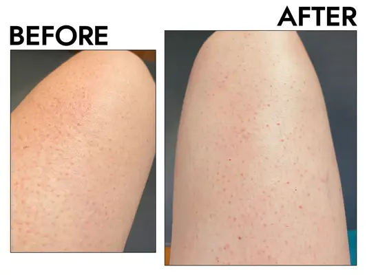 Glytone Exfoliating Body Lotion