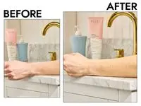 Before and after photos of a person