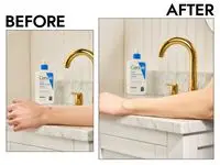 Before and after photos of a person