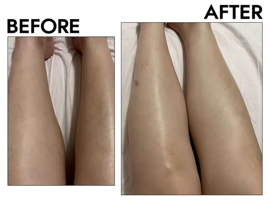 eos Shea Better 24H Moisture Body Lotion before after