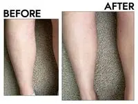 Neutrogena Hydro Boost Body Lotion Gel Cream before after