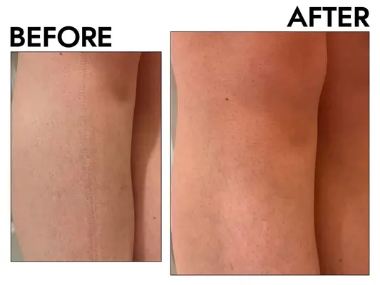 Nivea Essentially Enriched Hand and Body Lotion before after