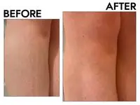 Nivea Essentially Enriched Hand and Body Lotion before after