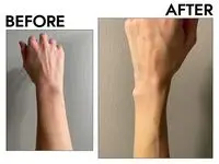 Saltair Body Lotion before after
