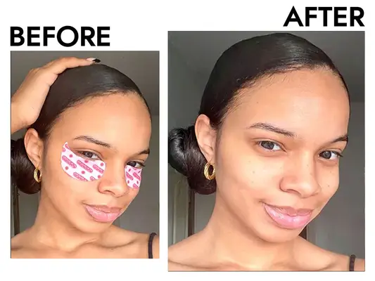 Hero Cosmetics Mighty Patch for Tired Eyes Patches