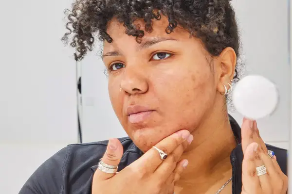 Person applying a dark spot corrector to their jawline with their hands