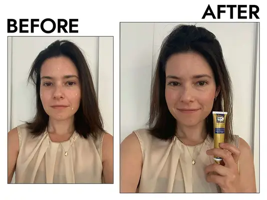 Person’s face before and after using RoC Retinol Correxion Deep Wrinkle Night Cream
